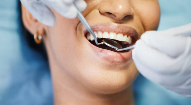 Best Emergency Gum Treatment in White Cloud, MI