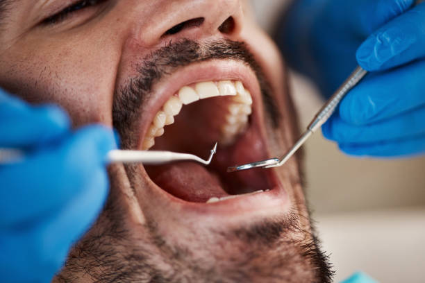 Best Emergency Denture Repair in White Cloud, MI